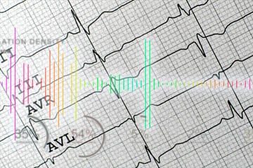 modern technology medicine analysis, 3d heartbeat projection b