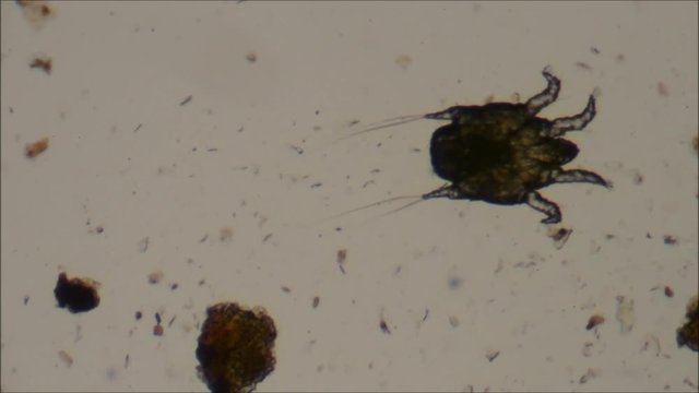 cat ear mite to microscope