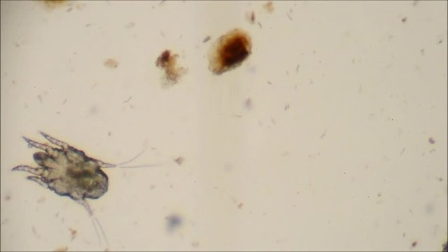 cat ear mite to microscope, pregnant female with eggs inside