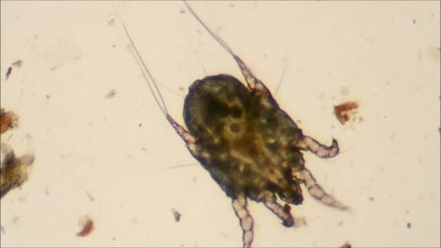 cat ear mite to microscope, pregnant female with eggs inside