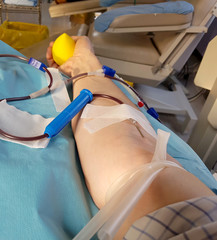 volunteer during the donation blood with tourniquet