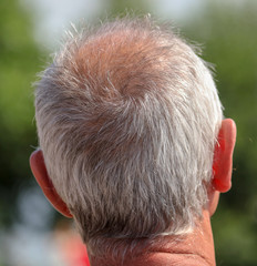 Bald head on a man's head with testosterone