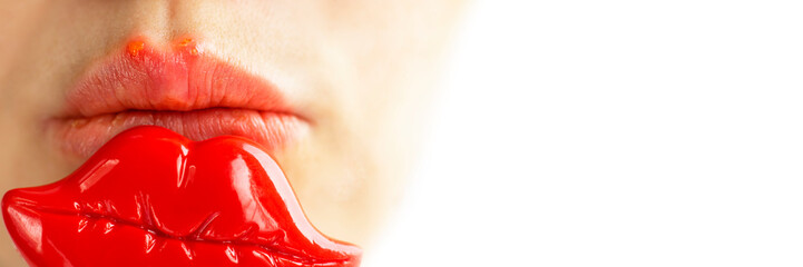Part of a young woman face with red bubbles of virus herpes on lips that she tries to hide with toy lips for photo on patry. Medicine, treatment. Long horizontal banner with copy space Selective focus - obrazy, fototapety, plakaty