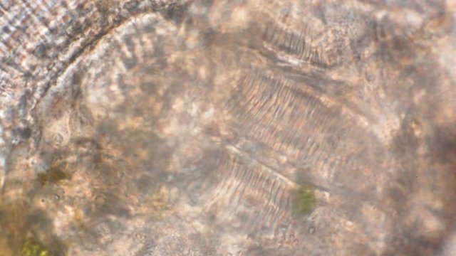 An unknown organism moves under a microscope.