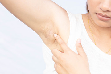 Women problem black armpit on white background for skin care and beauty concept