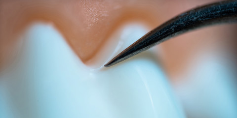 Fototapeta premium Concept Dental care