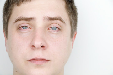 Fototapeta premium Ophthalmology, allergies, tearing. Portrait of a man who is crying