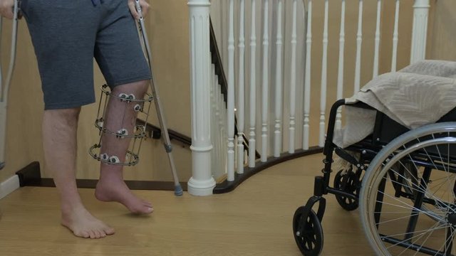 Climbing the stairs on crutches with a broken leg in Ilizarov's external fixative. Close-up. A person in a wheelchair.