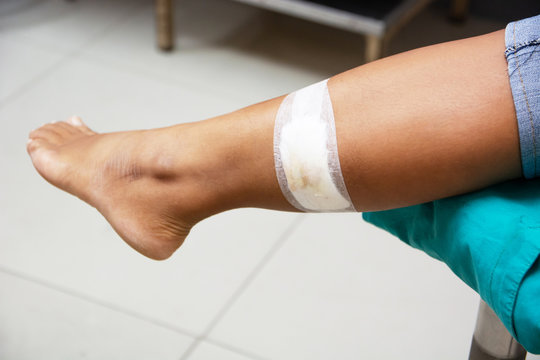 The doctor is making bandage wound on the legs of a woman.