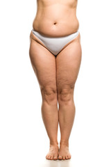 Belly, legs and waist of overweight woman on white background