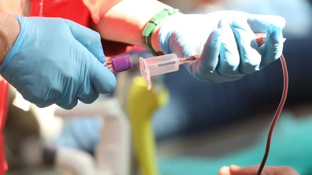 Blood Donation, Nurse receiving blood from blood donor in hospital. Blood tests to check your health before work, Nurse Working with Blood Donor at Hospital, Blood Plasma Fractionation, Squeezing Stre