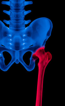 X-ray of lower half length human skeleton anterior view red highlight in the femur or thigh bone pain area- 3D medical and Biomedical illustration- Human anatomy concept- Blue tone color