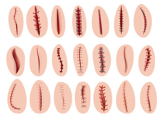Suture icons set. Cartoon set of suture vector icons for web design