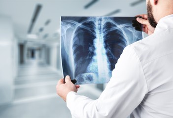 Young man doctor holding x-ray - obrazy, fototapety, plakaty