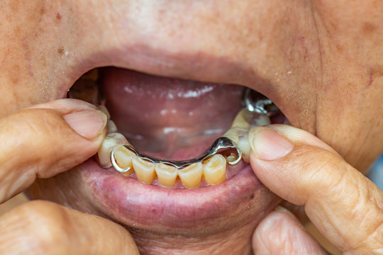 Artificial teeth gripped by the hand of senior's  woman, Acrylic and Vitallium metal, Stomatology & False Dentures set concept, Close up & Macro shot, Selective focus
