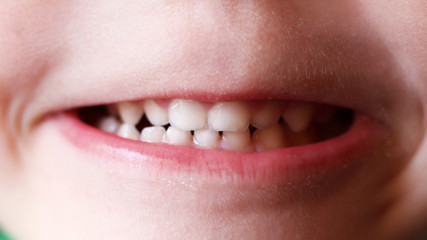 Mouth of a 5 years old boy. Closeup