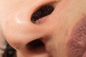 A closeup view of nose hairs inside the nasal cavities of a Caucasian male.