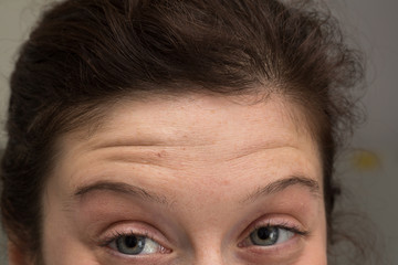 Closeup view on the eyes and forehead of a frowning lady, showing the wrinkles and pores in the area above the eyes