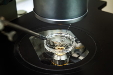 Microscope for in vitro fertilization process close up. The process of artificial insemination in IVF clinic.