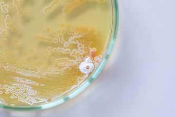 Backgrounds of Characteristics and Different shaped Colony of Bacteria and Mold growing on agar plates from Soil samples for education in Microbiology laboratory.
