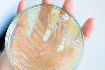 Backgrounds of Characteristics and Different shaped Colony of Bacteria and Mold growing on agar plates from Soil samples for education in Microbiology laboratory.