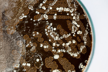 Backgrounds of Characteristics and Different shaped Colony of Bacteria and Mold growing on agar...