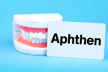 Aphthen als Erkrankung des Zahns beim Zahnarzt