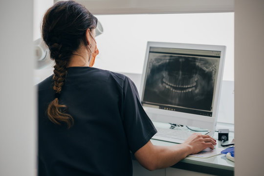 Orthodontist in the dental clinic showing an x-ray on the comput