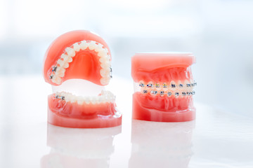 Orthodontic model and dentist tool - demonstration teeth model of varities of orthodontic bracket...