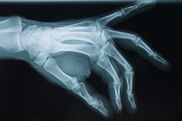 Naklejka premium Detail of the x-ray of the bones of the human left hand