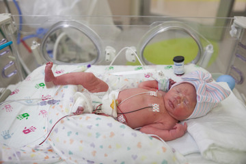 baby in NICU