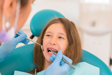 Macro close up of young child with open mouth at dentist. Teeth checkup at dentist's office. Dentist examining girls teeth in the dentists chair
