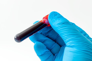Blood analysis, clinical or medical testing and phlebotomy concept theme with close up on doctor...