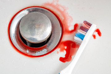 Bleeding gums when brushing the teeth and gingivitis concept theme with close up on a dental floss...