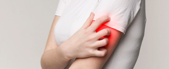 Woman scratching her red itching hand, panorama,