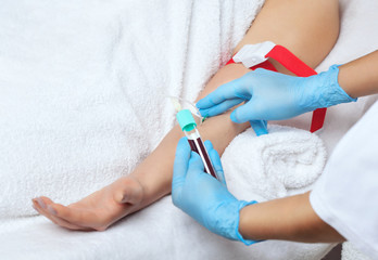 The procedure for taking blood from a vein to separate blood plasma in a centrifuge.Prp procedure