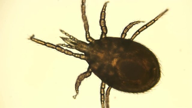 mite Hypoaspis under a microscope, from the order Mesostigmata, lives in the soil, is a predator 4K