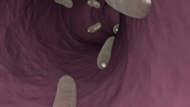 3D animation of parasitic worms in an intestines of human or animal.
