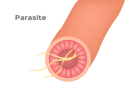 parasite in stomach and intestine vector