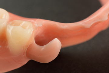 image of a modern denture