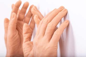 group silicone prosthesis hands, medicine pink implants