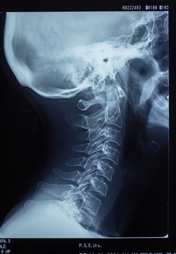 Radiography, in profile of the human skull.