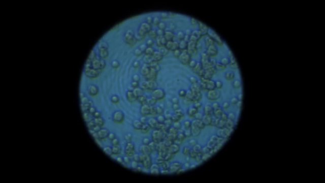 Human blood under the microscope