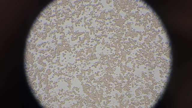 Human blood under the microscope