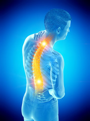 3d rendered medically accurate illustration of a mans painful back