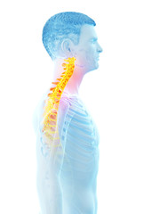 3d rendered medically accurate illustration of a mans painful neck