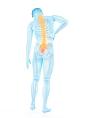 3d rendered medically accurate illustration of a mans painful back