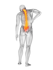 3d rendered medically accurate illustration of a mans painful back