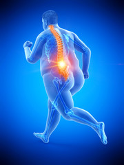 3d rendered medically accurate illustration of an obese runners painful back