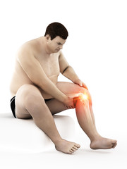 Obraz premium 3d rendered medically accurate illustration of an obese mans painful knee